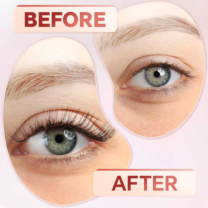 Before and after result