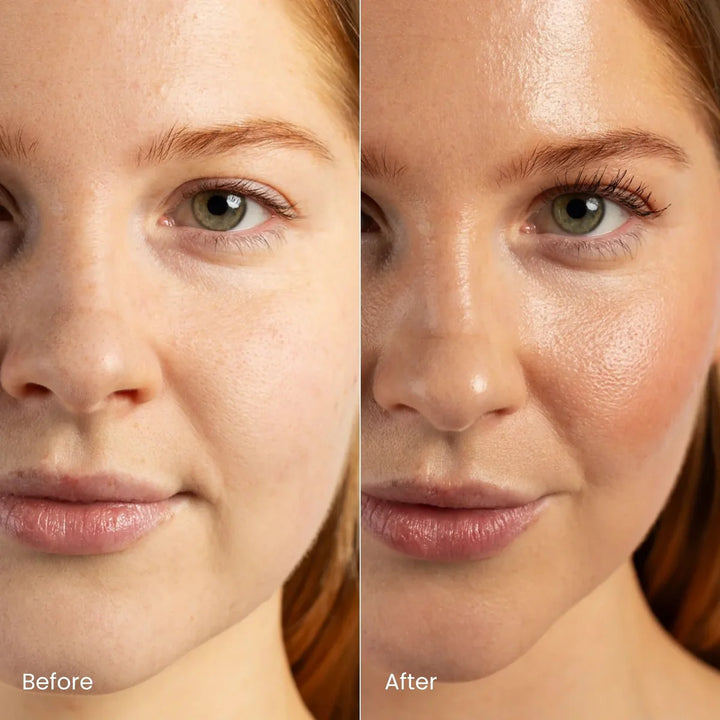 Before and after result