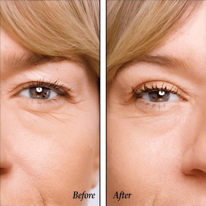 Before and after result